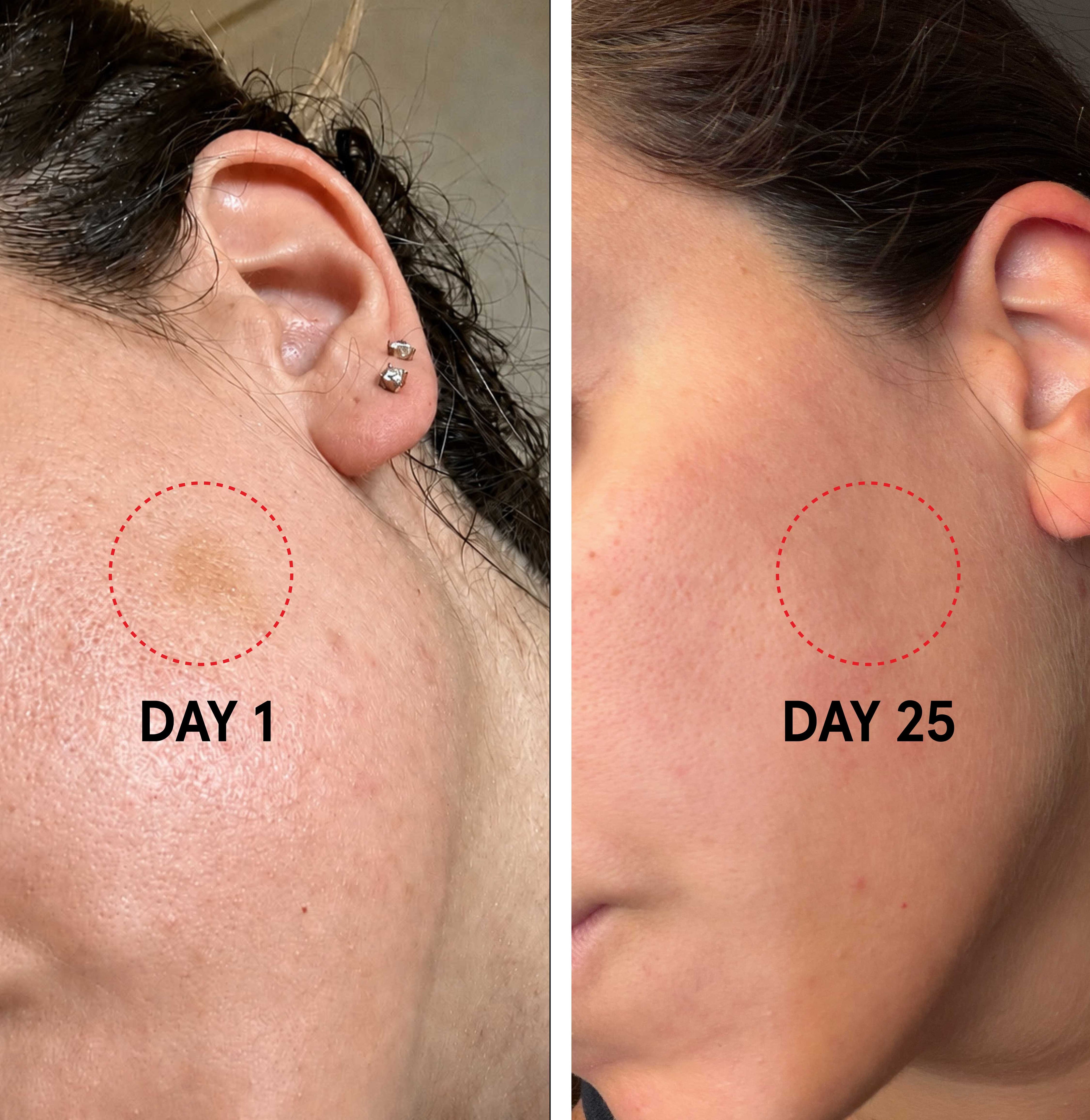 sos-BEFORE-AFTER_8e849b80-89cf-4da3-bb50-7ab79a38e4c7.jpg